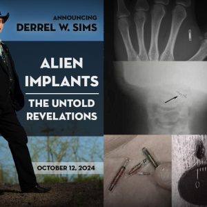 Alien Implants - The Untold Revelations