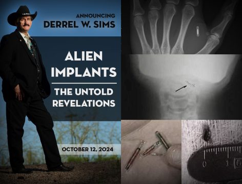 Alien Implants – The Untold Revelations